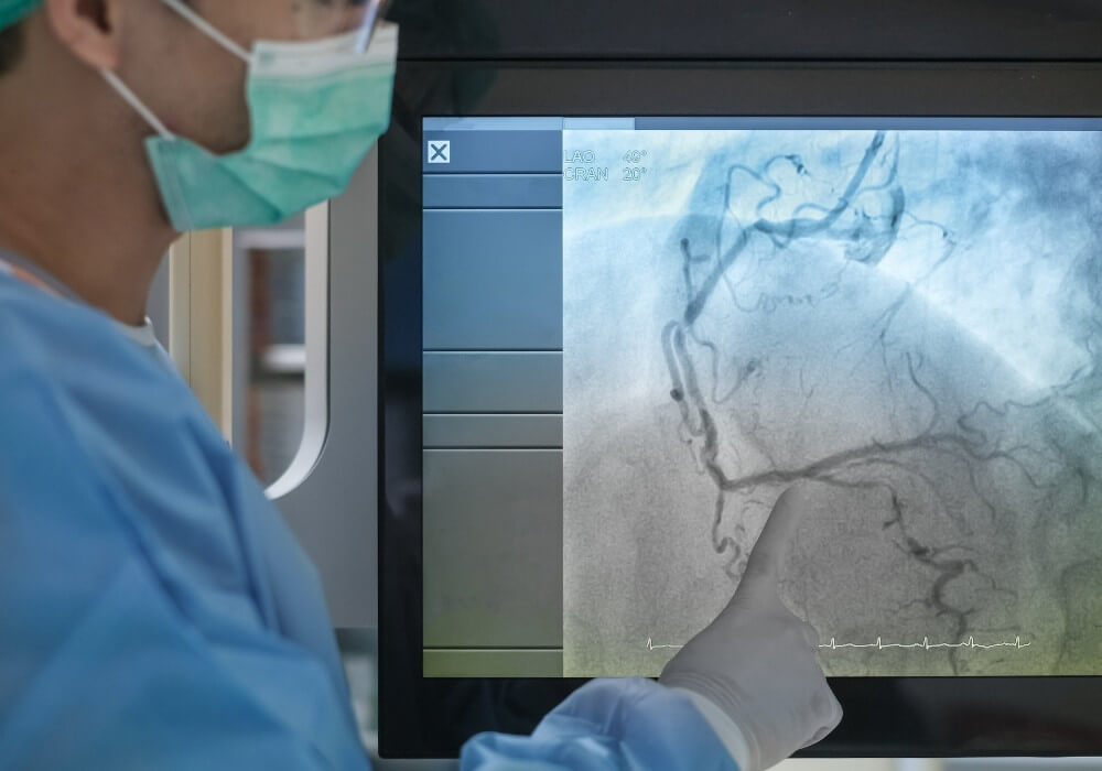 Coronary Angiogram