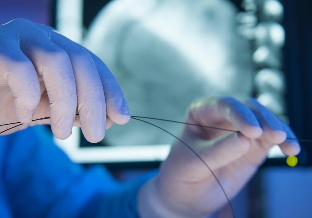 Peripheral Angioplasty Procedures