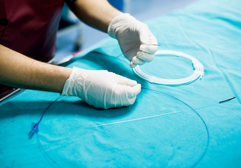 Renal Artery Stenting Procedure