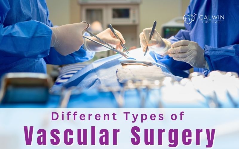 Types of Vascular Surgery