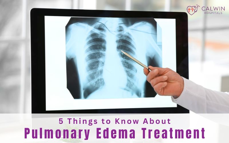 Pulmonary Edema Treatment