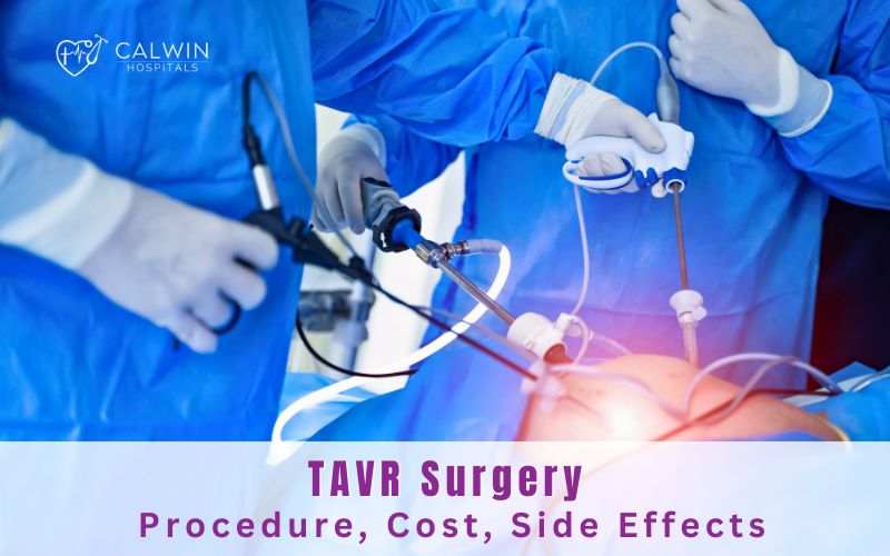 TAVR Surgery - Procedure, Cost, Side Effects